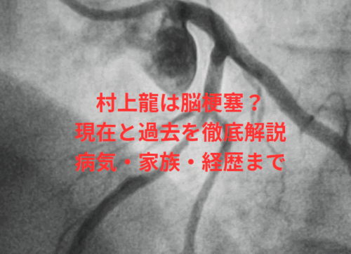村上龍は脳梗塞？現在と過去を徹底解説｜病気・家族・経歴まで