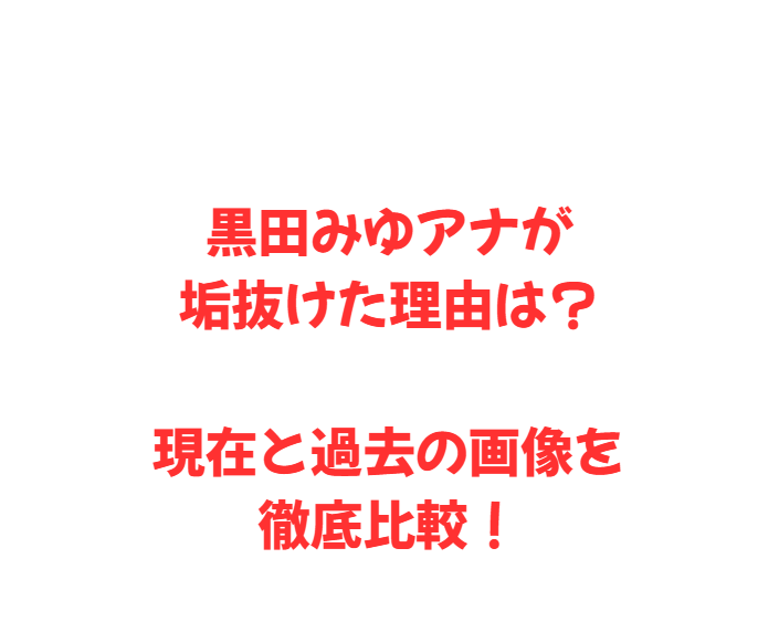 黒田みゆアナが垢抜けた理由は？現在と過去の画像を徹底比較！